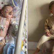 Rocco Dowsett went through multiple surgery to fix the heart problem he was born with.