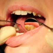 Dentists are continuing to face high demand for their services in Ipswich