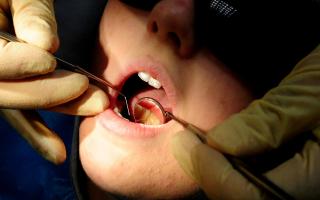 People are being told to wait until 2024 for dentist appointments while others are being removed from their practice lists for not making appointments sooner,.